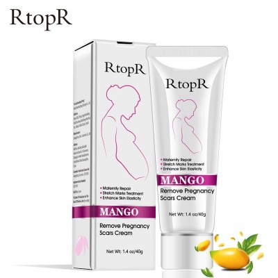 Oem Mango Stretch Marks Remover Scar Removal Powerful Postpartum Obesity Pregnancy Cream Anti-aging Anti Winkles Firming Body